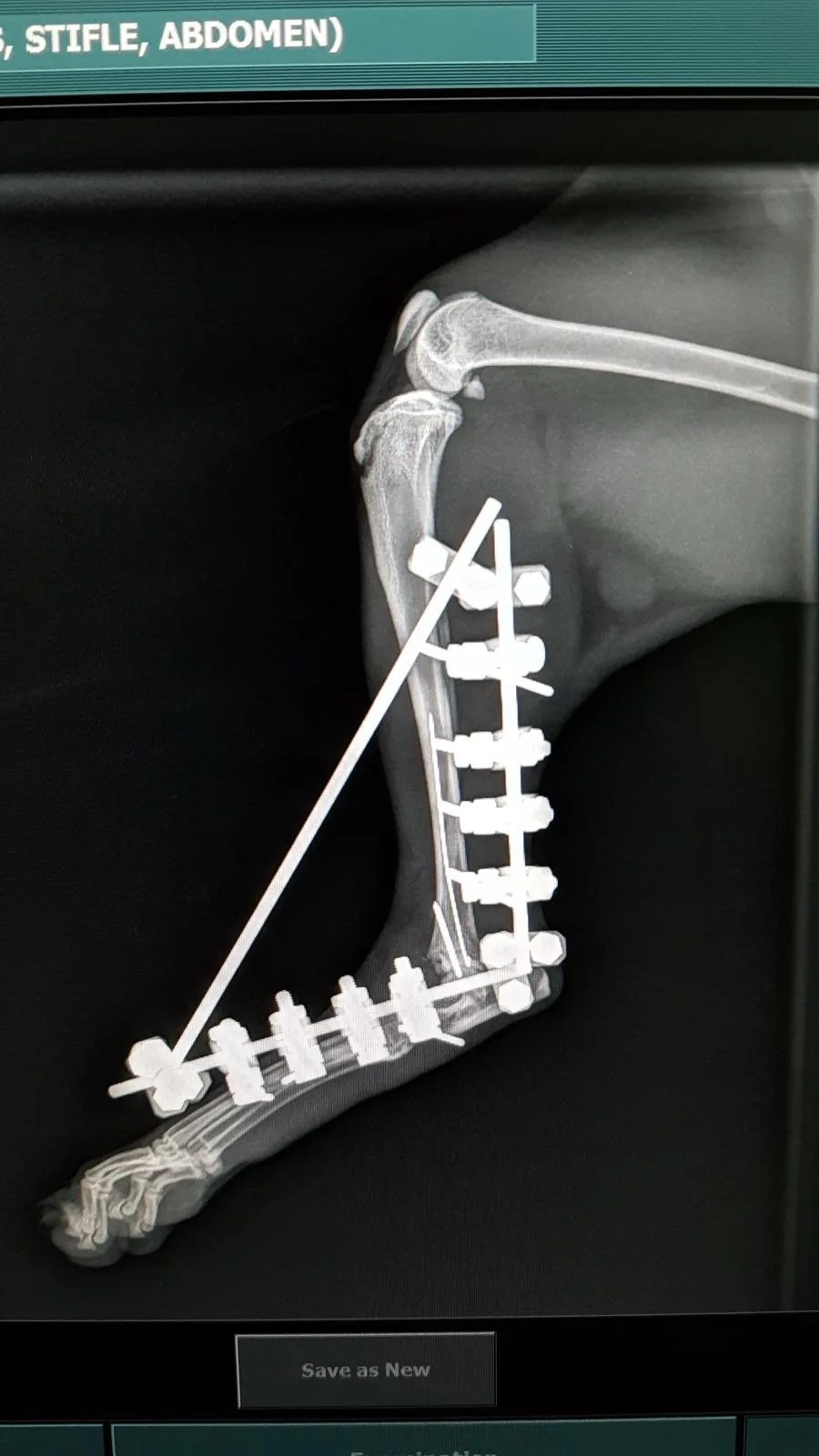 Matilda X-ray with external fixator