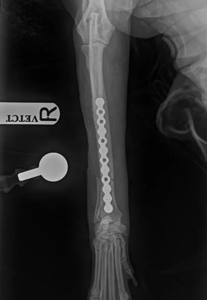 Archie radius X-ray after plate repair